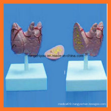 Medical Educational Natural Size Thyroidea Model